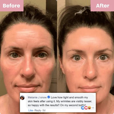 Elurne Glass Skin Collagen Mask™