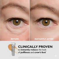 Elurne Instant Eye Lift Serum™